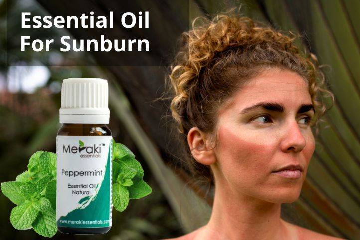 Peppermint Essential Oil For Sunburn